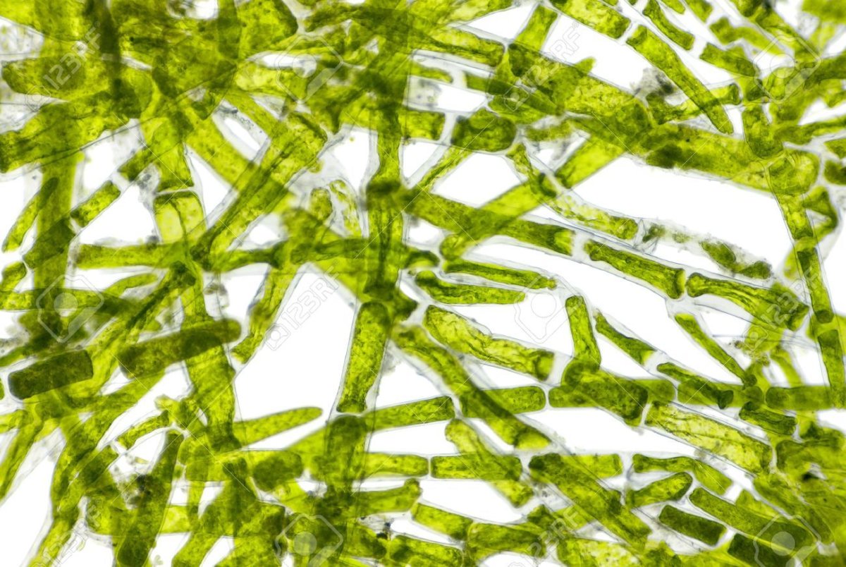 Водоросли в пробирке. Нитчатые водоросли микроскоп. Кладофора клетка. Кладофора водоросль микроскоп. Кладофора водоросль под микроскопом.